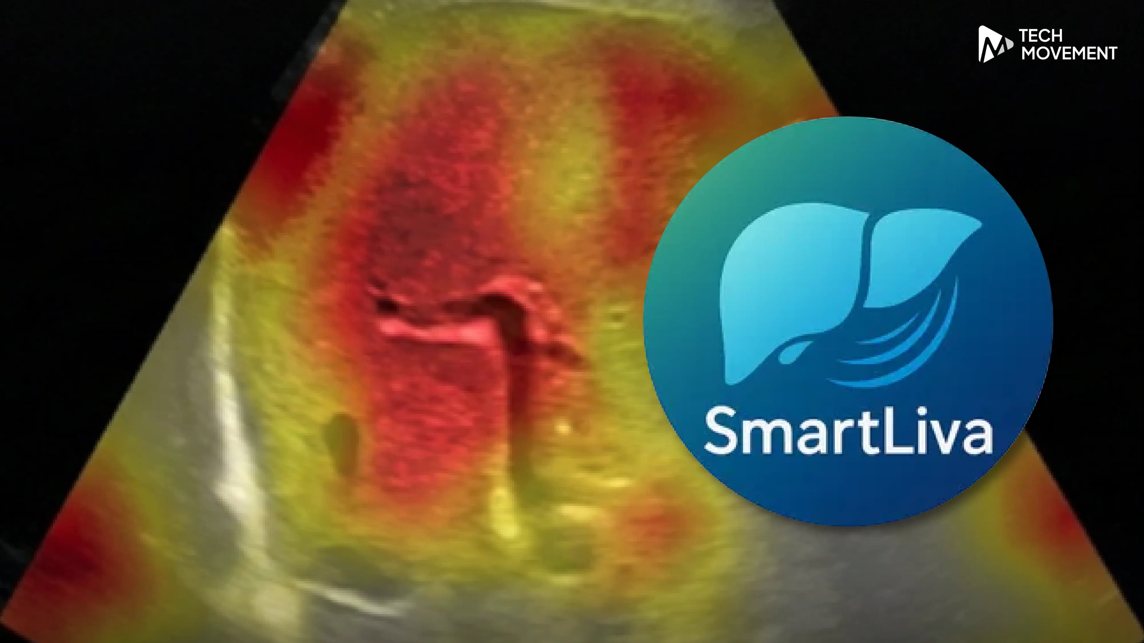 AI_ตรวจโรคตับฝีมือคนไทย_รู้ผลใน_7_วินาที_ลดค่าตรวจเหลือหลักร้อย